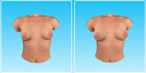 3D моделирование груди