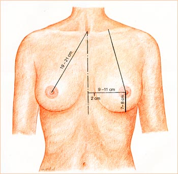 Увеличение груди или коррекция груди не требуется. Идеальная форма груди